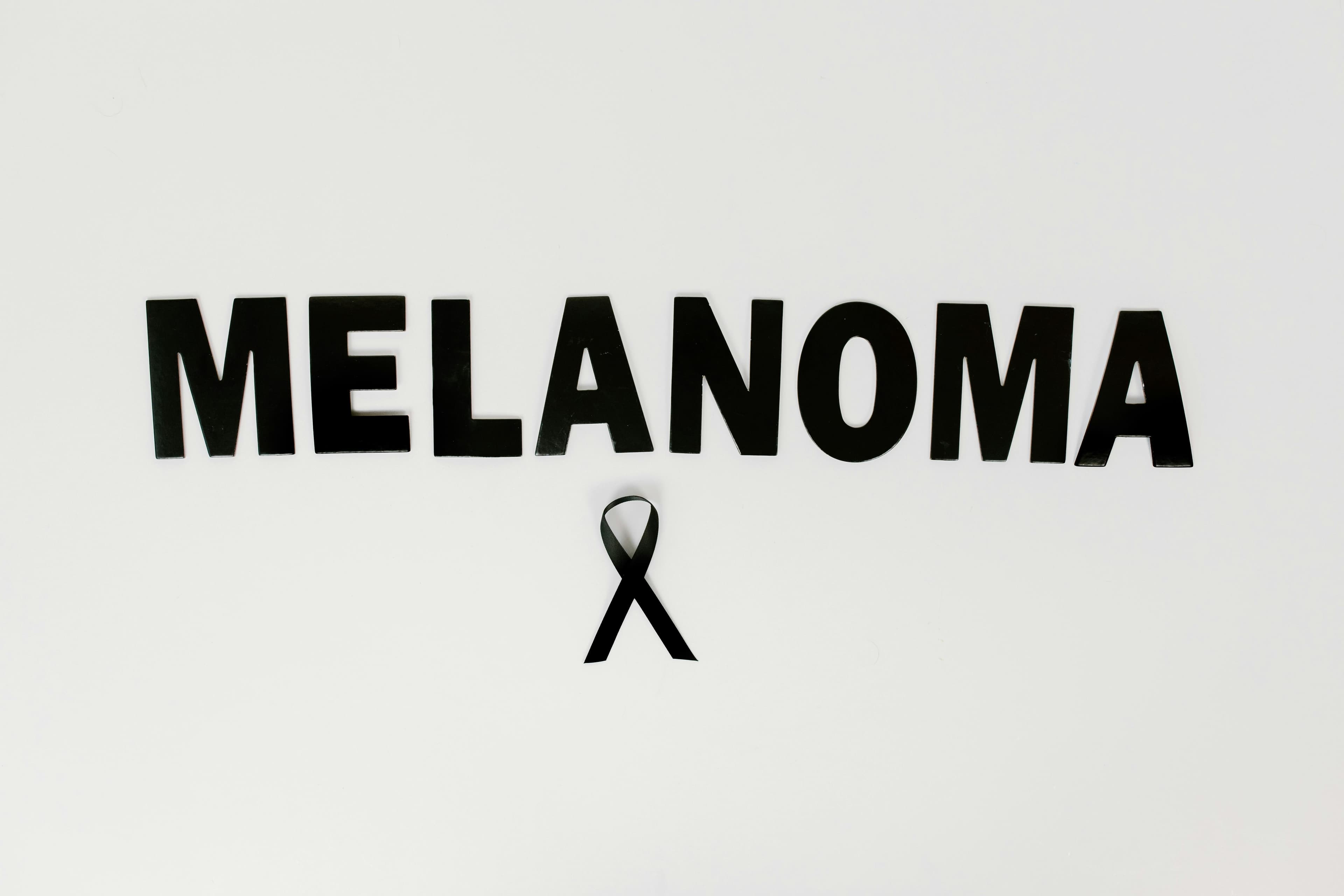 Atipični madeži i rizik melanoma: što znače i treba li ih ukloniti?
