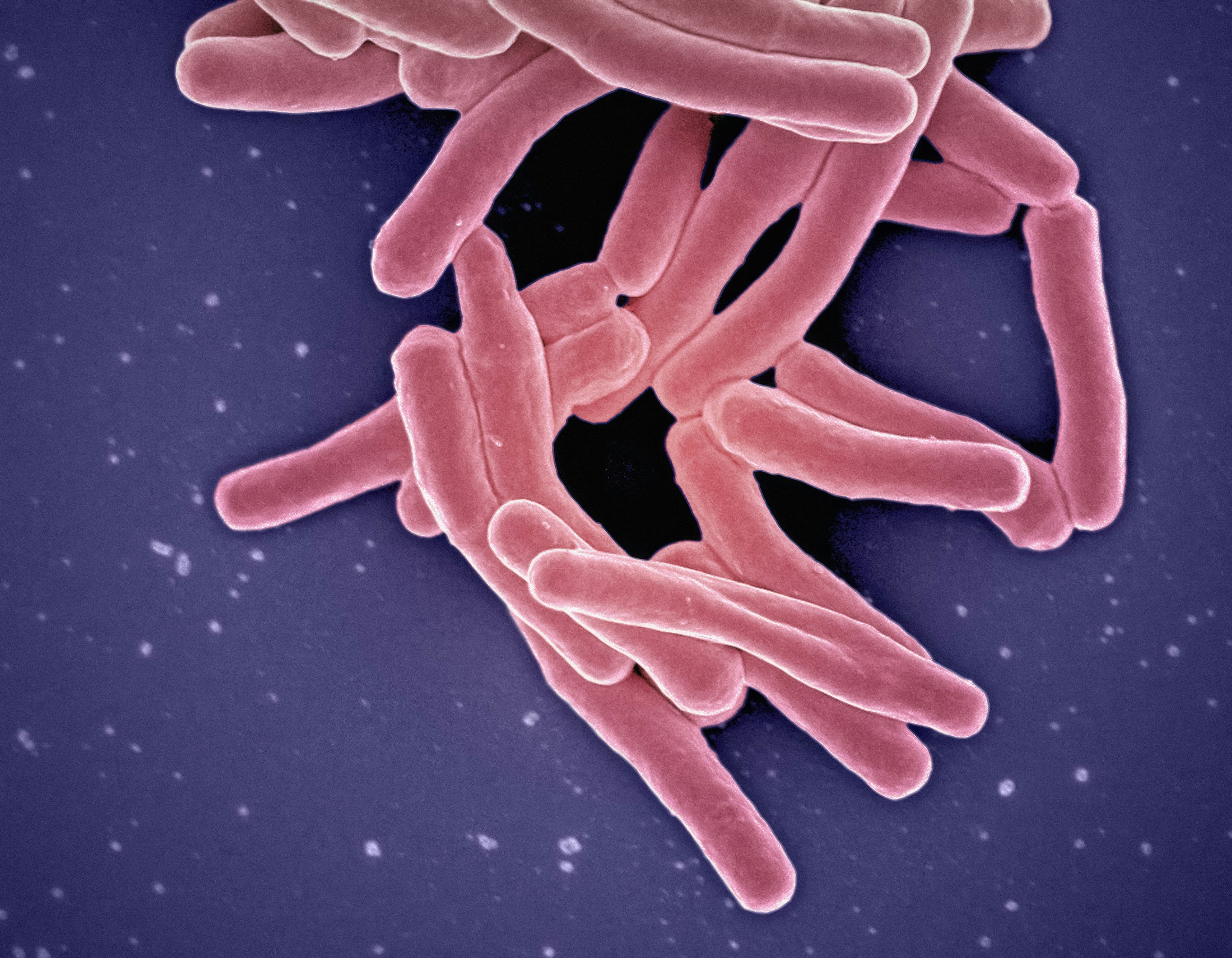 H. pylori: testirati, liječiti, potvrditi izlječenje – vodič kroz korake