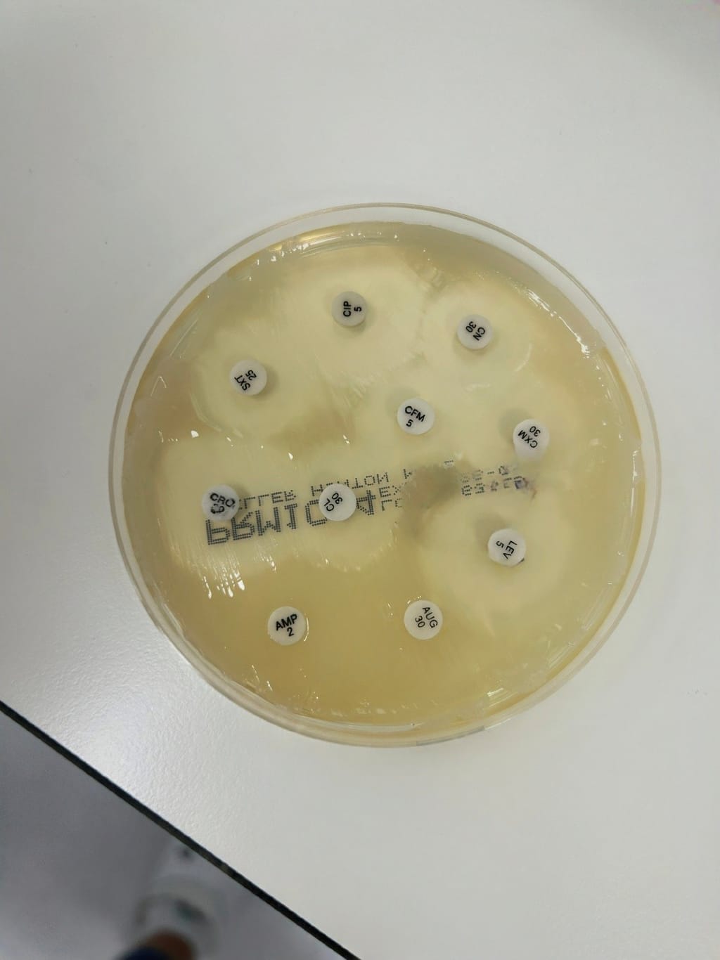 antibiogram