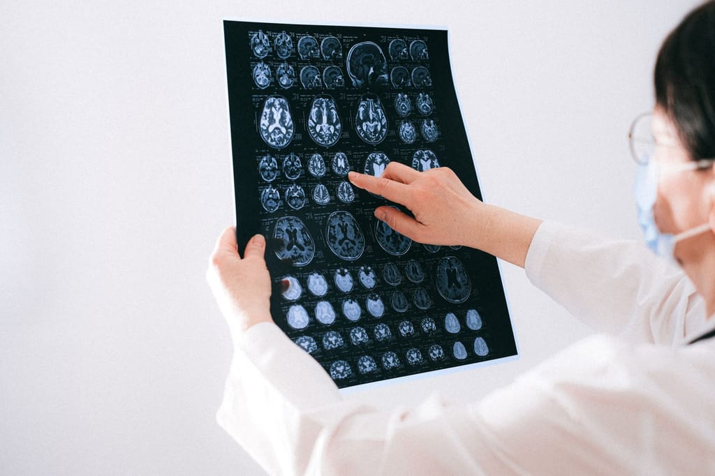 Liječnica pokazuje na snimku magnetske rezonancije mozga