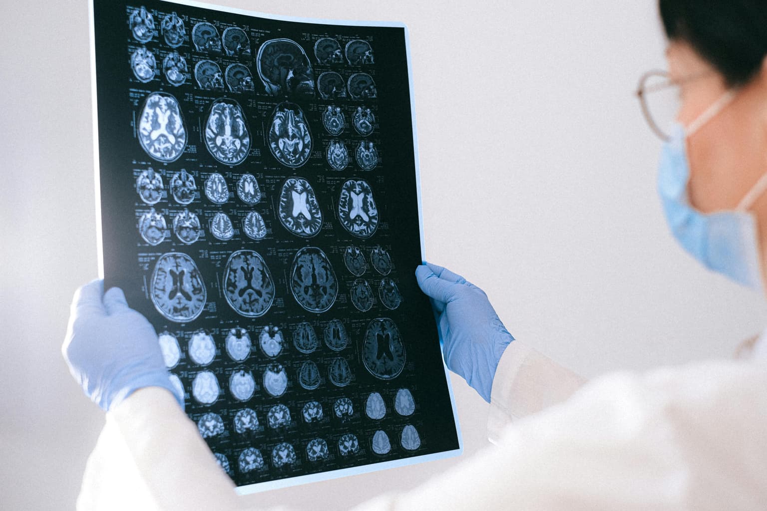 Krvni test koji bi mogao promijeniti dijagnostiku Alzheimera