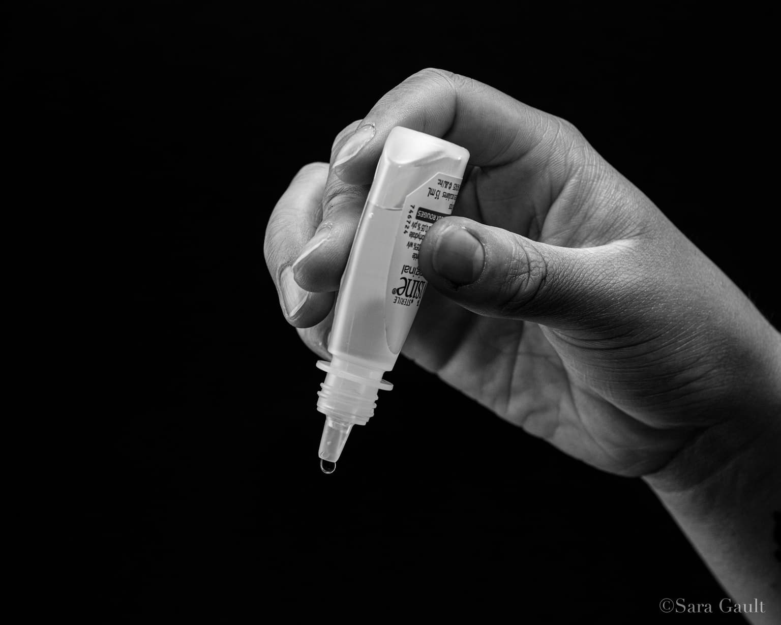 Crveno oko: kada je hitno, a kada je „samo“ konjunktivitis — što smijete, a što nikako ne