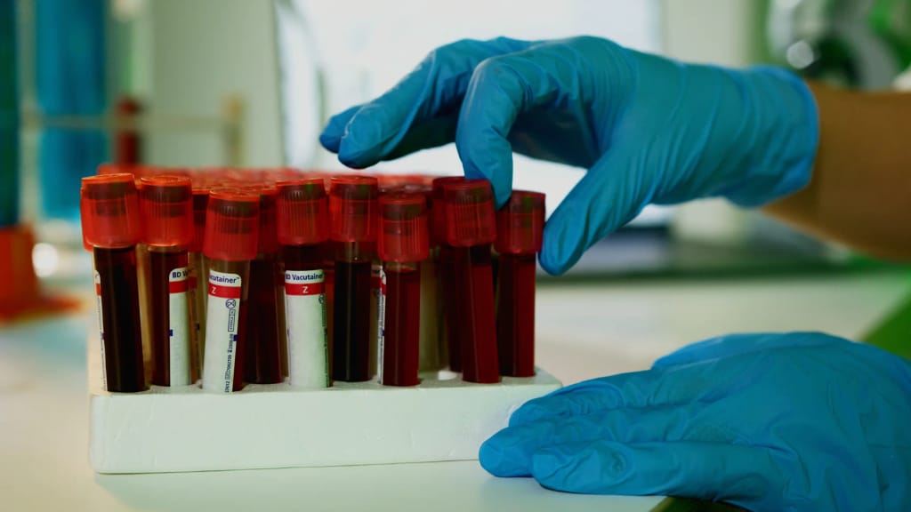 Laboratorijski tehničar u rukavicama slaže epruvete s uzorcima krvi